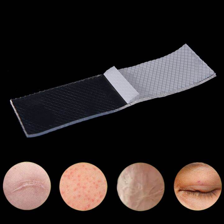 reusable-scar-removal-sheet-12cm-breathable-silicone-patch-for-c-section-surgical-burn-acne-scars-keloid-post-acne-stretch-marks