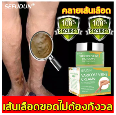 【ผู้ขายในท้องถิ่น】SEFUDUN รักษาเส้นเลือดขอด ยาทาเส้นขอด เส้นเลือดขอด 50g รักษาขาให้สวย รักษาขาให้สวย ครีมหลอดเลือดดำบอกลาเส้นเลือดขอด คร