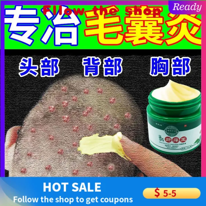 【Ready Stock】【 Genuine 】It is specially used for scalp folliculitis ...