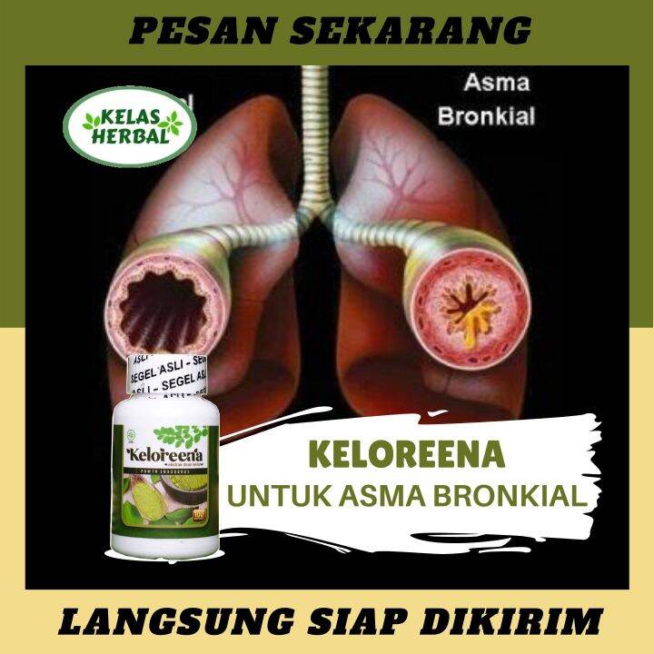 Obat Asma Bronkial - Obat Herbal Untuk Asma Bronkial - Obat Penyakit ...