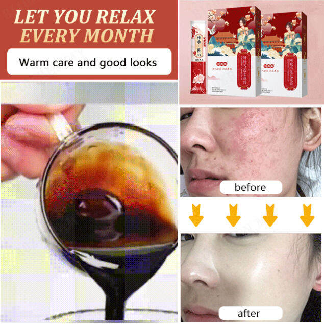 biaozhen Donkeyhide gelatin Saussurea sevenflower ointment