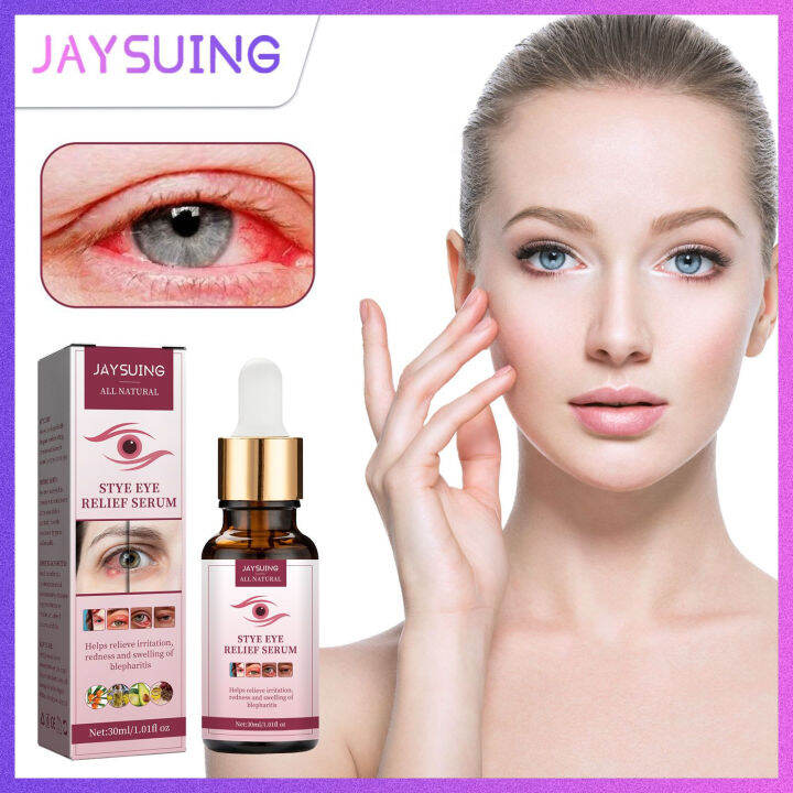 Jaysuing Stye Eye Relief Serum Helps Relieve Irritation Redness And