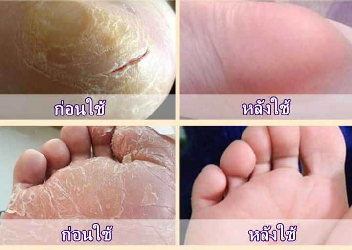 ครีมทามือวาสลีน-ครีมทามือแก่-ครีมทามือแห้ง-ครีมทามือ-ครีมบำรุงมือ-แฮนด์ครีมโลชั่น-ครีมบำรุงผิว-แฮนครีม-ครีมทามือนุ่มๆ-hand-cream