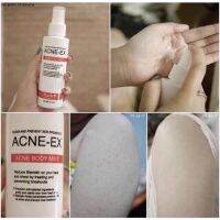 ? ? ACNE-EX Acne Body Spray สเปรย์ฉีดสิ วที่ผิวกาย หลัง คอ แบรนด์ h.a.b+ 120ml แอคเน่ เอ็กซ์ บอดี้ มิส [ Beauty ]