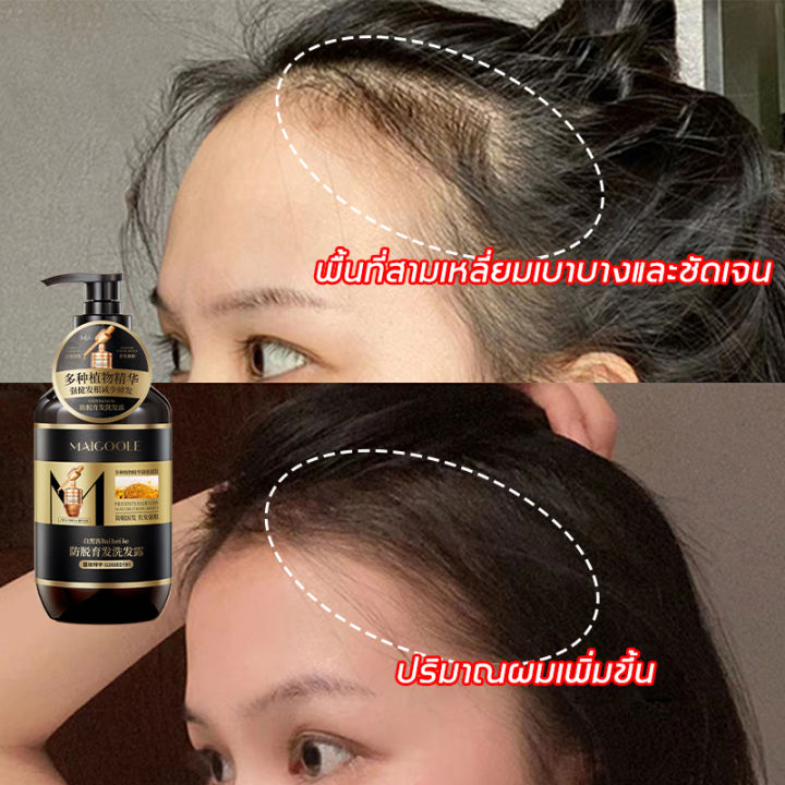 จัดส่งในวันเดียวกัน-maigoole-แชมพูแก้ผมร่วง-แชมพูปลูกผม-400ml-60ml-บำรุงหนังศรีษะ-แชมพูสมุนไพร-ยาสระผมสมุนไพร-แชมพูลดผมร่วง