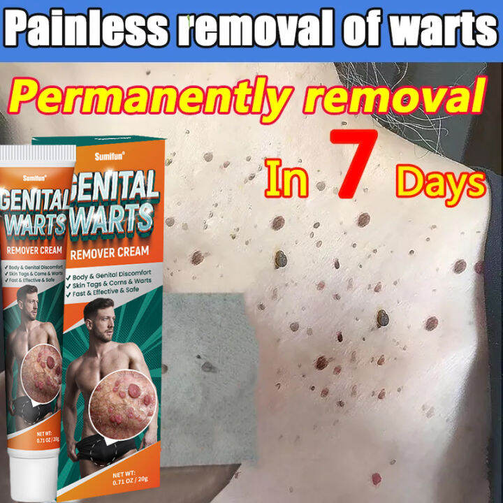 Private Genital Warts RemoverAntibacterial Cream for Whitening