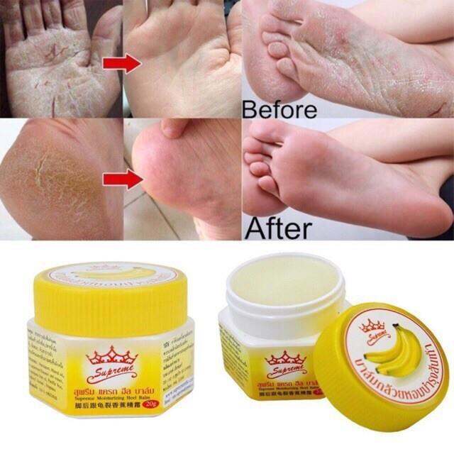 Thailand Supreme Moisturizing Heel Balm banana 5showshop | Lazada PH