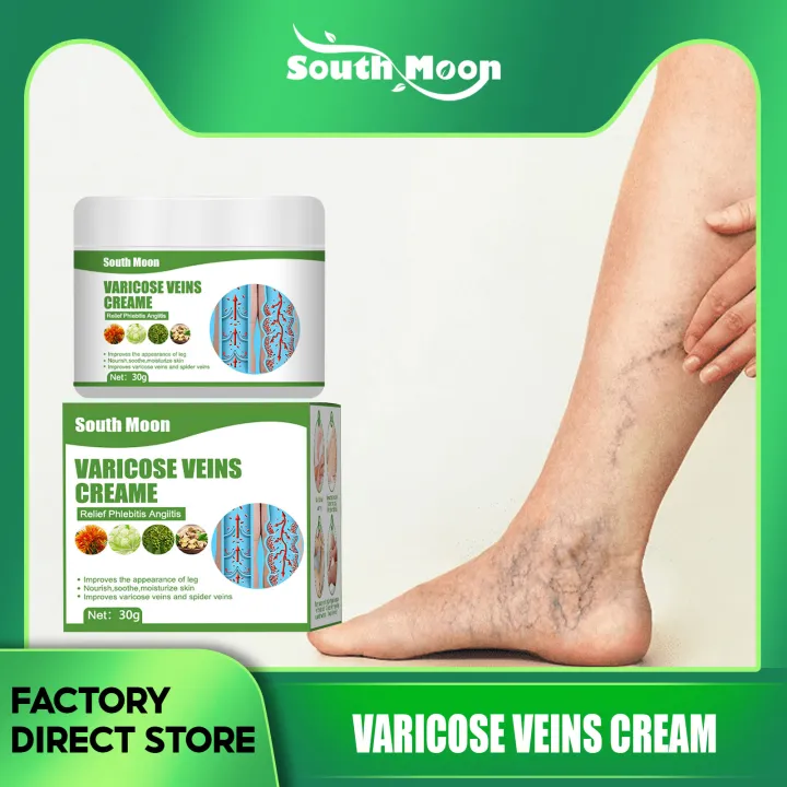 South Moon Varicose Cream 30g Varicose Vein Treatment Cream Relieves ...