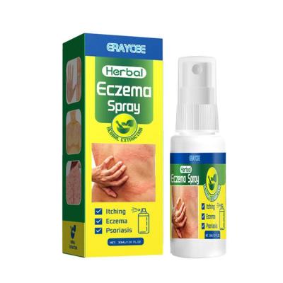 Anti Itch Spray Sting Relief Itching Spray Eczema Relief For Humans Plant Raw Material Light Texture 30ml for Foot Hand Scalp relaxing