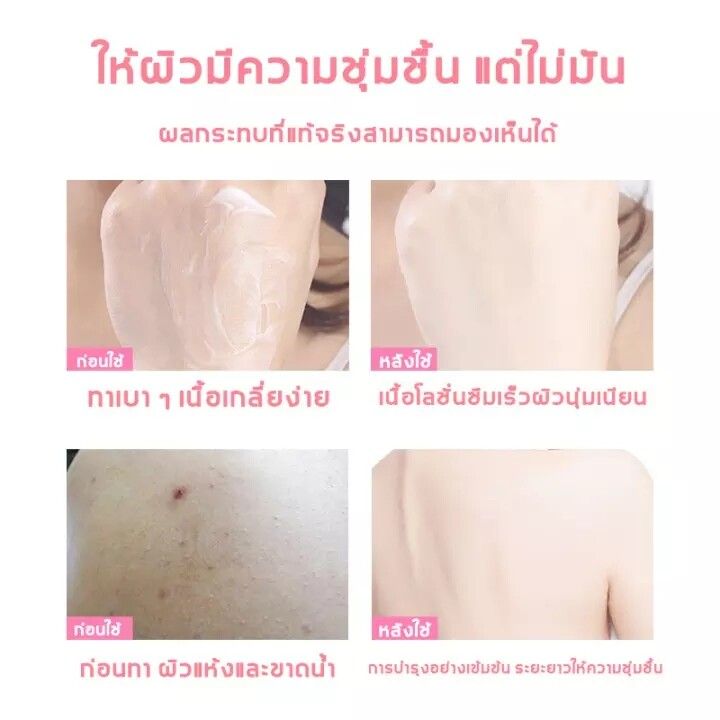 โลชั่นวิตามินซี-roushun-vitamin-c-body-lotion-สารสกัดวิตามินซีเข้มข้น-บำรุงผิวขาวกระจ่างใส-ชุ่มชื้นยาวนาน-ให้ผิวเรียบเนียน