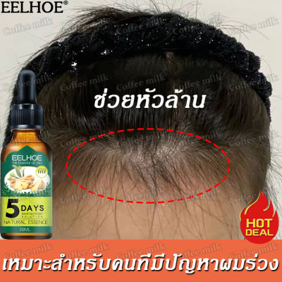 บอกลาหัวล้าน EELHOE เซรั่มปลูกผม 30มลส่งเสริมการเจริญเติบโตของเส้นผมตามธรรมชาติป้องกันผมร่วงแก้ปัญหาผมร่วง น้ำยาปลูกผมชาย น้ำยาเร่งผมยาว น้ำยาปลูกผม ยาปลูกผมของแท้ ยาปลูกผม ปลูกผมเร่งด่วน เซรั่มเรงผมยาว ทรีทเมนต์สำหรับผม Hair Growth