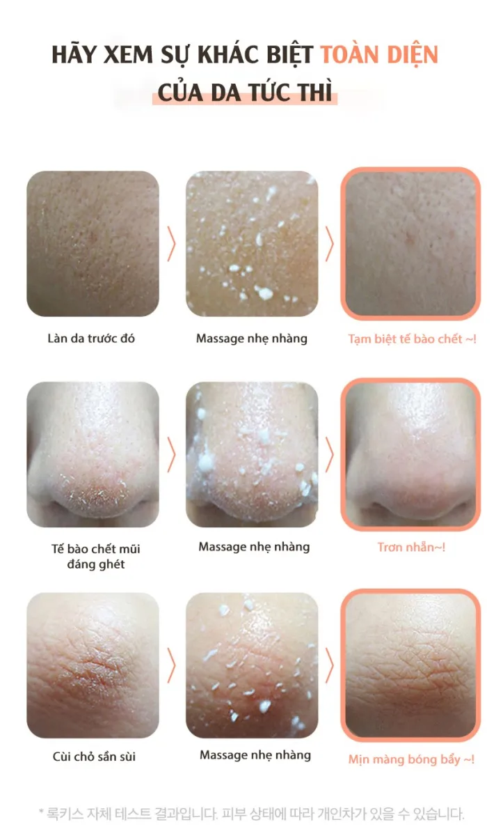 Gel tẩy tế bào chết chiết xuất tràm trà ROKKISS TEA TREE PEELING ...