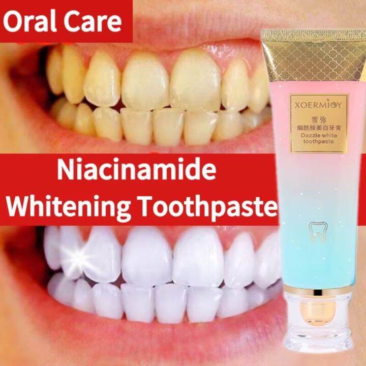 Niacinamide Whitening Toothpaste Remove Stains Fresh Breath Bright ...