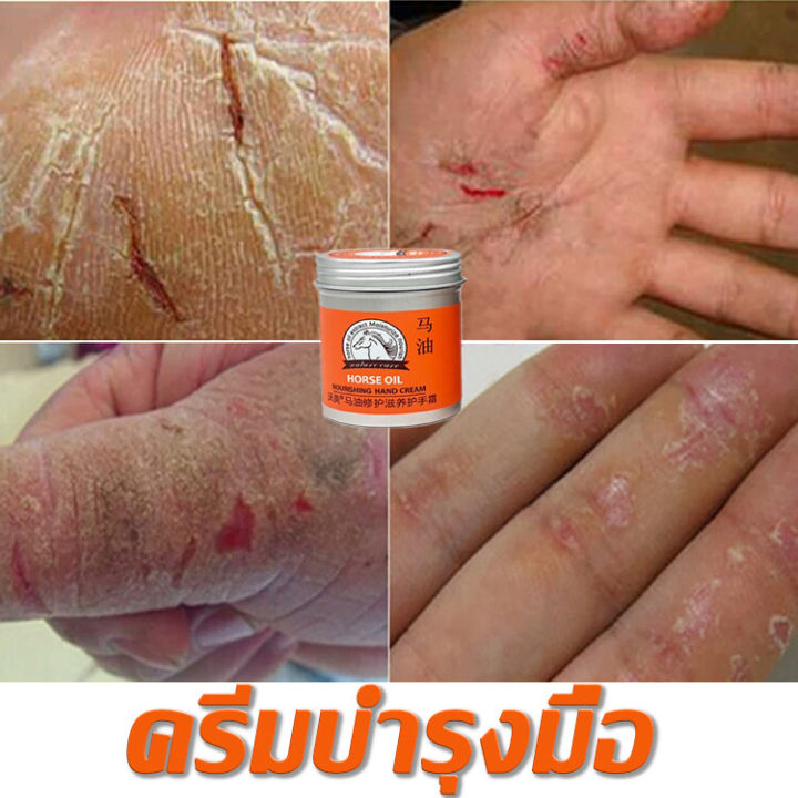 ครีมทามือแตก-ยาทามือแห้งแตก-แฮนด์ครีม-ครีมทามือน้ำมันม้า-ครีมทามือลอก-ช่วยแก้ไขปัญหาผิวหนัง-แห้งหร้าน-ผิวลอก-บำรุงผิวมือ-hand-cream