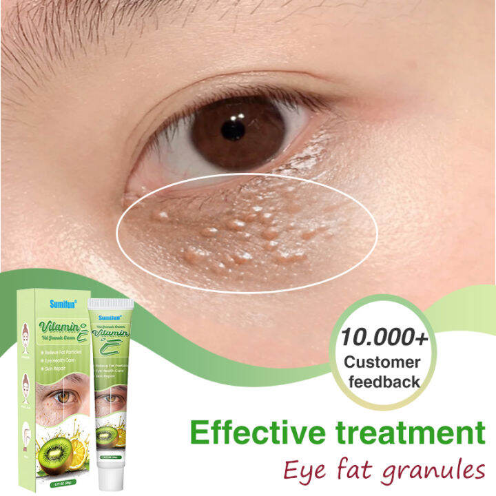 VITAMIN E EYE CREAM 20G REMOVE EYE FAT PARTICLES Lazada