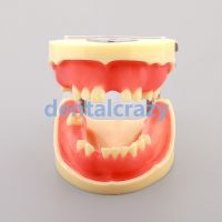 1Pc Dental Implant Practice Model Dental Teeth Models M2002 Tools Models Dentist