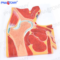 Spot parcel post Human Body MRI Hip Joint Skeletal Muscle Section Structure Anatomy Model Orthopedics Pain Department Teaching Specimen