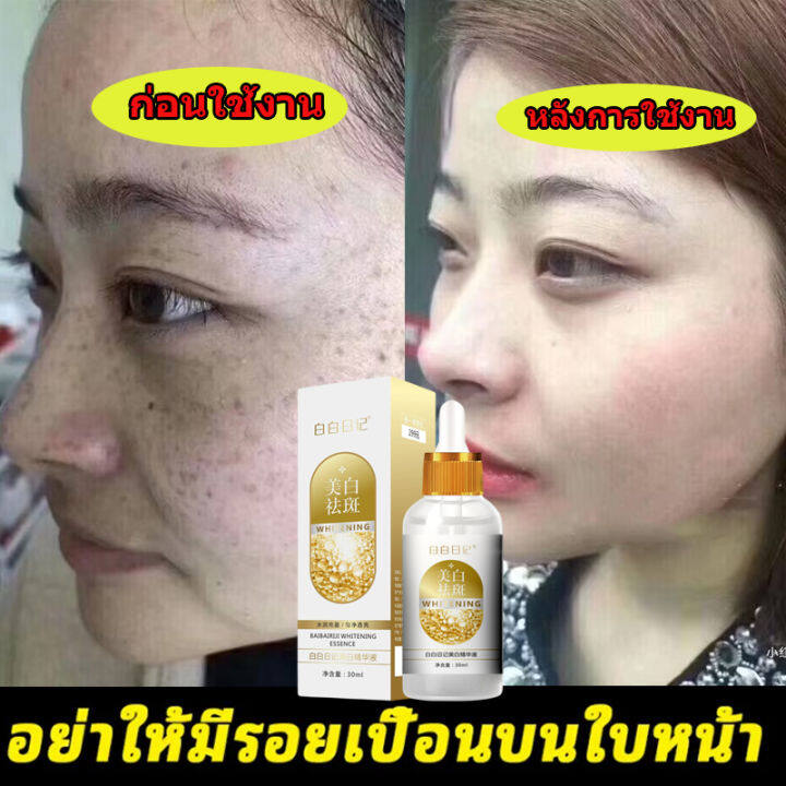 กำจัดกระอย่างถาวร-สปอต-ไลท์เทนนิ่ง-เอสเซ็นส์-30ml-สิว-ฝ้า-ริ้วรอย-จุดด่างดำ-ซ่อมแซมผิวหนัง-ปรับสีผิวให้กระจ่างใส-ลดฝ้ากระที่ฝังลึก