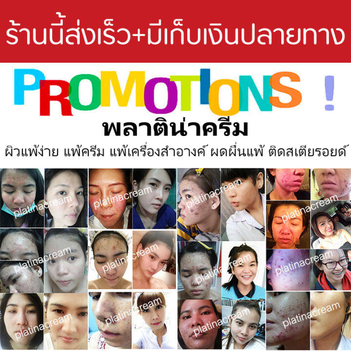 เซรั่มสำหรับคนเป็นสิว-ช่วยจัดการกับสิวอักเสบ-สิวหนอง-สิวฮอร์โมน-สิวอุดตัน-บำรุงผิวให้ชุ่มชื่น-พลาติน่าครีม-platina-cream