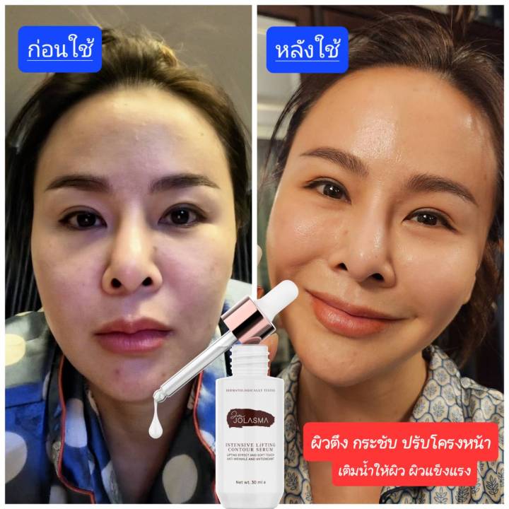 jolasma-contour-serum-โจลาสม่าเซรั่มสเต็มเซลล์แบบทา-หน้าเด็ก-ย้อน-วัย-ของแท้จากบริษัท