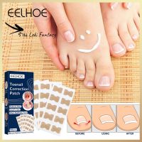 ร้าน Loki Fantasy Nail Correction Patch Foot Care Pedicure Tool Fixer Ingrown Toenail Corrector Foot Care Kit Glue-Free Nail Corrector Patch Pedicure Tools candid