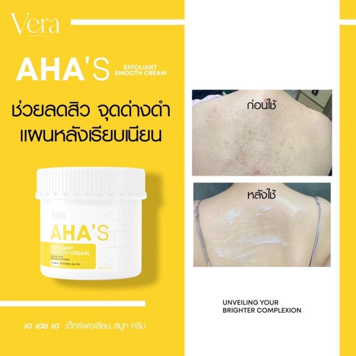 พร้อมส่ง-ส่งฟรี-aha-s-exfoliant-smooth-cream-ครีมahaทาผิวกาย-สูตรเข้มข้น5x-ผลัดผิวขาวใสเร่งด่วน