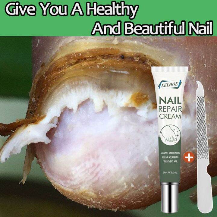 Eelhoe Nail Repair Cream Repair Cream Painless Removal Anti