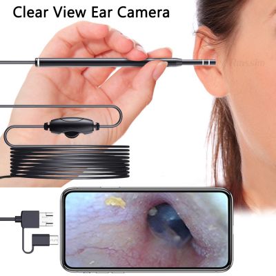 【YF】 NEW Cleaning Otoscope Ear Endoscope Picker Wax Removal Mouth Visual Toothpicks