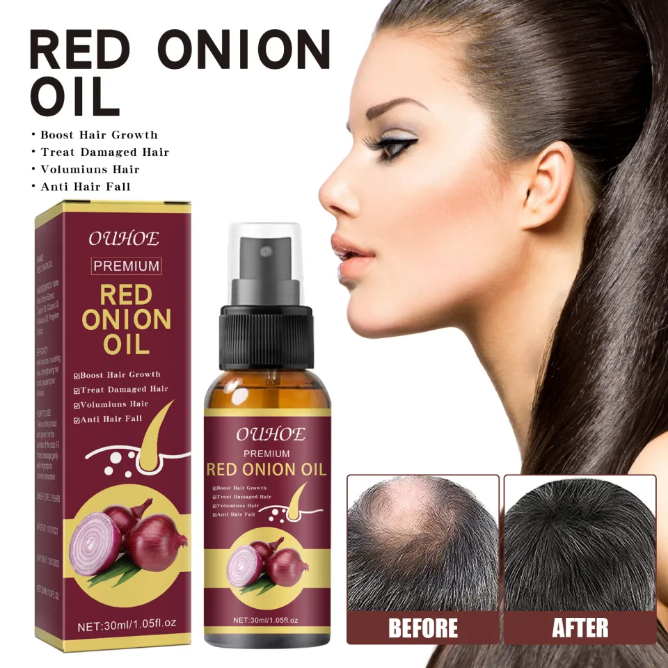 Ways To Use Onion Juice For Faster Hair Growth