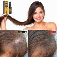 Hair growth castor oil spray สเปรย์ดูแลหนังศรีษะลดการหลุดล่วงของเส้นผม