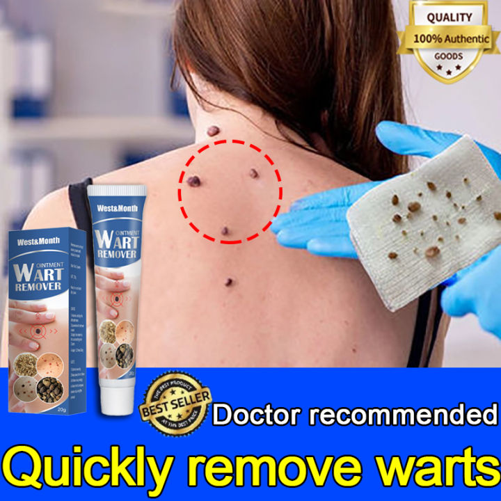 Wart Removal Ointment Fast Remove Skin Tag Remover Original Ointment Against Mole And Genital Wart