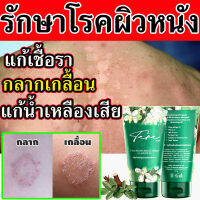 ?พร้อมส่ง?(หยุดสังฆัง) สมุนไพร ? ครีมทารา ? 1 หลอด ทาแก้อาการคันในร่มผ้า ยาทาสังคัง