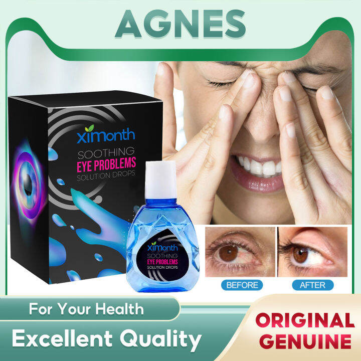 Ximonth Eye Problems Solution Drops Eye Soothing Remove Eye Dark