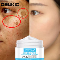 Whitening Freckle Cream Remove Melasma Acne Spot Pigment Melanin Care Spots Dark Skin Pigmentation Moisturizing Gel