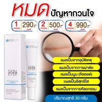 คีลอยด์ ครีมลบรอยแผลเป็น SkinEver ขนาด 30 ML 1 หลอด 190 บาท ส่งฟรี