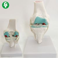 First stage lesions in the knee joint function ligament model attached to the ligament human bones teaching practice in medical functions show the neck spine simulation skeleton skeleton skeleton bone