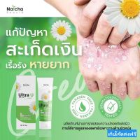 ของแท้ 100% Natcha Ultra U นัชชา อัลตร้ายู ครีม ลดปัญหาผิว (30 g) เก็บโค๊ดส่งฟรี