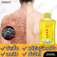 TANYA ครีมอาบน้ำกำจัดไร 200ML ีมอาบน้ำกำจัดสิวและไ  ับยั้งไร กำจัดสิว ป้องกันผิวแห้งกร้าน โฟมเยอะ อ่อนโยนไม่ระคายเคือง （ครีมอาบนำ้ลดสิว สบู่เหลว เจลอาบน้ำ ครีมอาบน้ำ สบู่ สบู่เหลว เจลอาบน้ำกำจัดไร ยับยั้งไร shower gel）