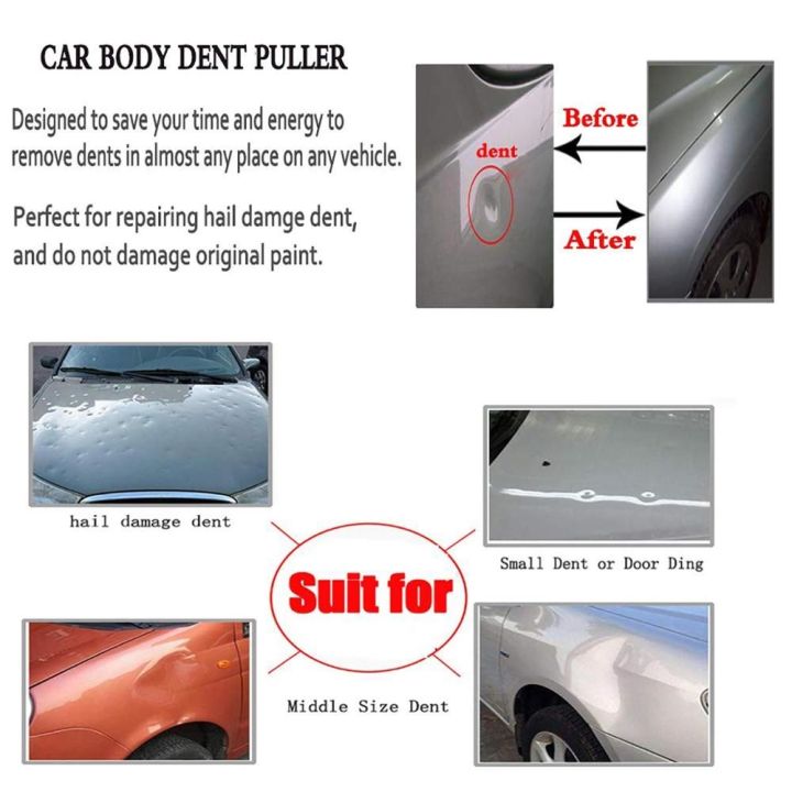 cw-paintless-dent-repair-kits-updated-with-tool-for-car-removal