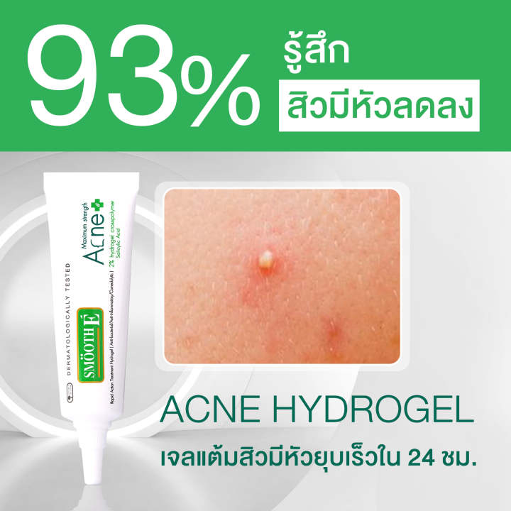 smooth-e-babyface-acne-set-เซ็ตดูแลสิว-จัดการทุกปัญหาสิว-ภายใน-24-ชม