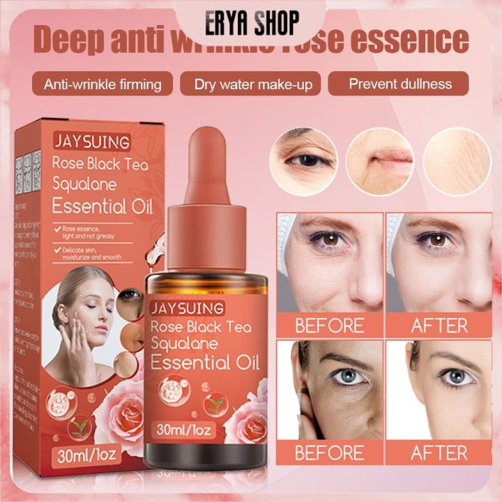 Jaysuing 30ml Rose Black Tea Squalane Serum Prevents Dullness And Dryness Hydrates Anti 