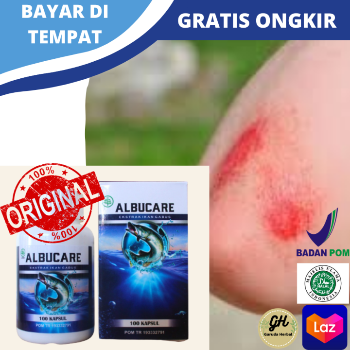 Obat Luka Lecet(Abrasi), Herbal Untuk Mengatasi Luka Lecet Di Kepala, Muka Atau Wajah, Badan
