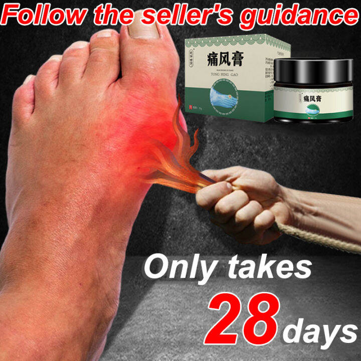 Foot gout treatment cream 35g High uric acid can cause gout and tendon