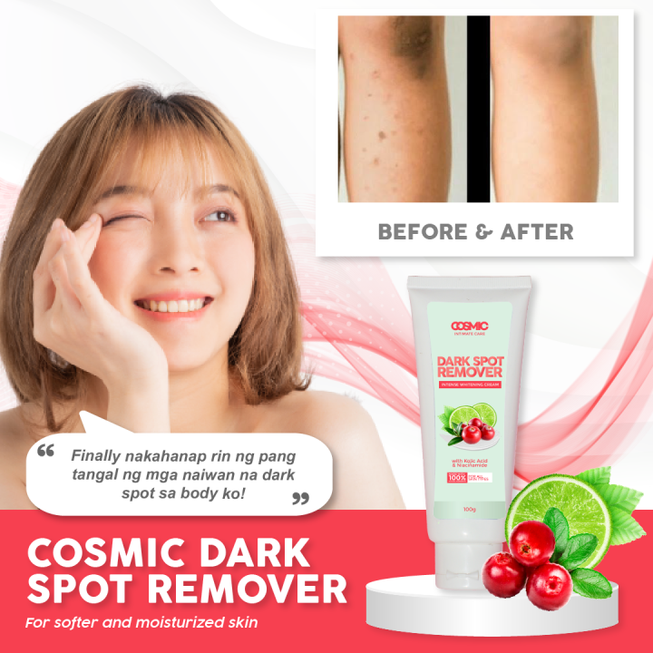 Cosmiclab Dark Spot Remover Cream 100g Lazada Ph 3634