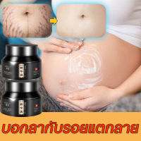 ครีมทาท้องลาย  ครีมลดรอยแตกลาย ลดรอยแตกลาย ครีมทาขาแตกลาย ครีมทาท้อง  50g Stretch marks รอยแตกลาย ครีมลดรอยดํา