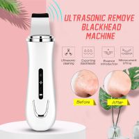 Sucking Out Blackhead Facial Pore Facial Blackhead Remover Vacuum Dead Skin Acne Pore Peeling Device Cleaning Skin Tool 3.7V