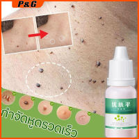 wart removal liquid เอสเซ้นลอกหูด 10ml ยาแต้มหูด ลอกหูดตาปลา ปลอดภัยไม่เจ็บตัว ขจัดติ่งเนื้อ เอสเซ้นลอกหูด ไม่ทิ้งร่องรอยป ครีมกําจัดไฝหูดติ่งเนื้อ