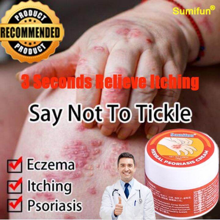 Eczema Treatment Cream Anti Itch Psoriasis Cream Ointment For Itchy
