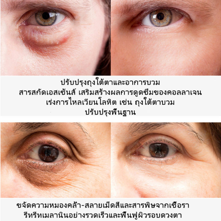 ครีมบำรุงรอบดวงตา-ครีมลดถุงใต้ตา-30g-ครีมทาขอบตาดำ-ครีมทารอบดวงตา-อ่อนโยนไม่ระคายเคือง-ใช้งานง่าย-พกพาสะดวก-ลบคล้ำบวมใต้ตา-ดูแลรอบดวงตา-บำรุงรอบดวงตา