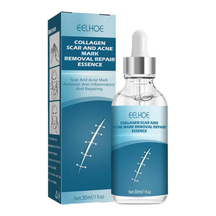 Scar Repair Liquid Pimple Mark Removal Essence Nourishing Scar Treat